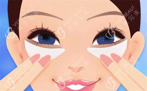 双眼皮术后卡通图 双眼皮术后卡通图