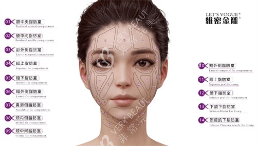 维密金雕可治疗部位 维密金雕可治疗部位