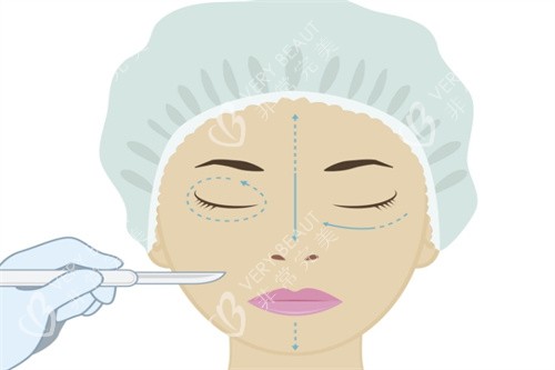 眼综合手术卡通图 眼综合手术卡通图