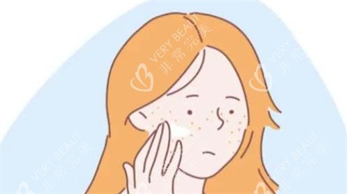 激光祛斑前 激光祛斑前