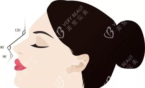 鼻整形示意图 鼻整形示意图