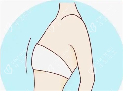 平胸动画展示图