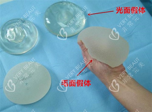 隆胸假体示意图