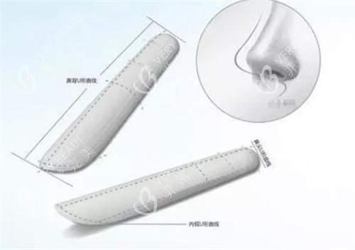 隆鼻假体形状图解