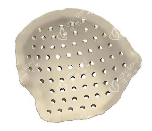 peek人工骨 peek人工骨