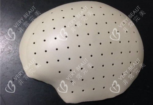 PEEK材料填充颅骨示意图 PEEK材料填充颅骨示意图