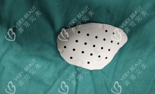 PEEK材料 PEEK材料