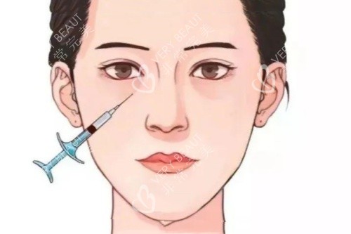 眼部注射卡通图 眼部注射卡通图