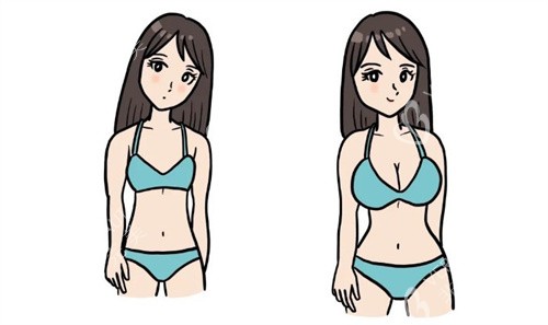 隆胸前后对比卡通 隆胸前后对比卡通