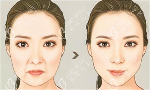 面部抗衰对比 面部抗衰对比