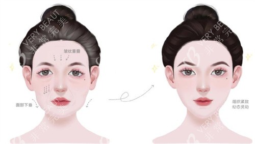 幼态脸前后紧致度对比 幼态脸前后紧致度对比