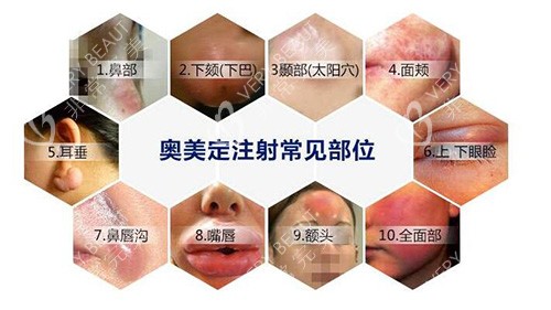 奥美定注射危害有哪些 奥美定注射危害有哪些