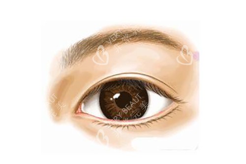 真实双眼皮示意图 真实双眼皮示意图