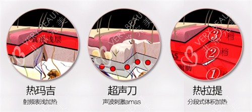 面部提升项目对比