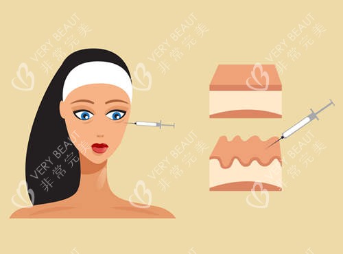 注射美容图示 注射美容图示
