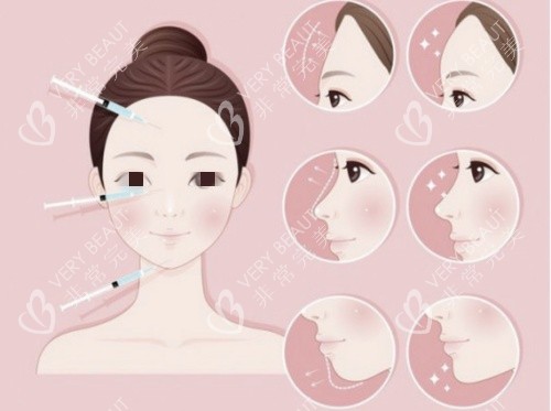 玻尿酸鼻基底填充示意图