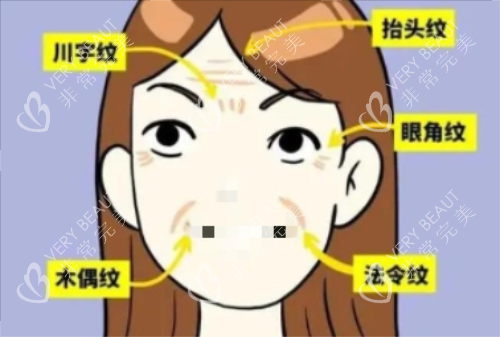 面部皱纹详细示意图 面部皱纹详细示意图