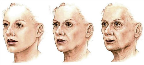 面部提升的皮肤前后对比 面部提升的皮肤前后对比