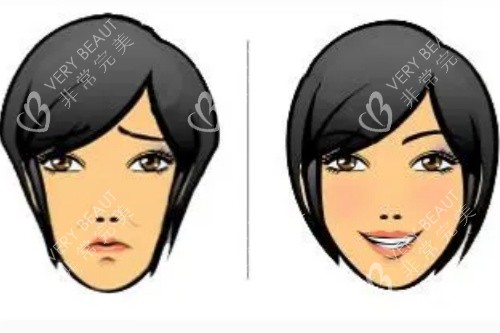 苹果肌填充对比图 苹果肌填充对比图