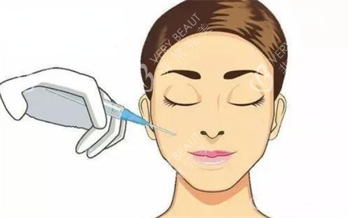 面部注射示图 面部注射示图