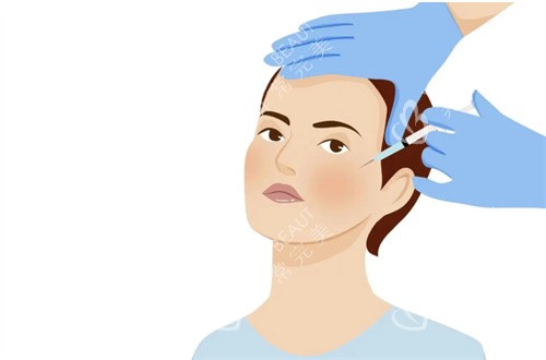 面部注射 面部注射