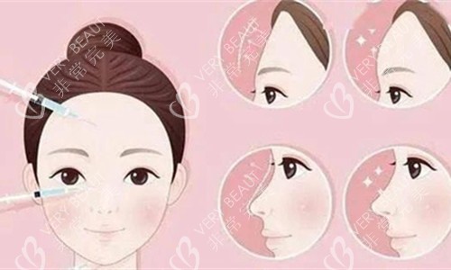 面部注射对比图 面部注射对比图