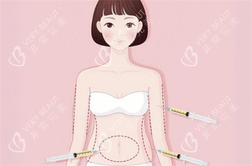 吸脂部位
