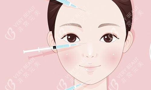 注射美容的部位示意图