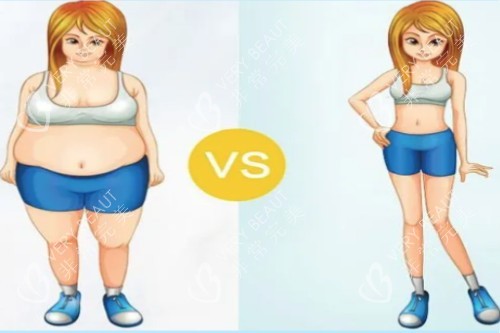 吸脂前后对比图 吸脂前后对比图