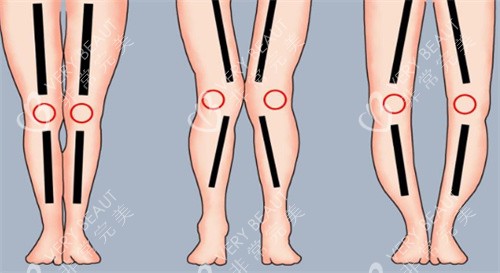 腿型动画图片