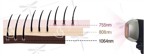 钛提升作用层次深度