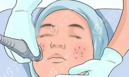 超声炮的操作动画示意图 超声炮的操作动画示意图