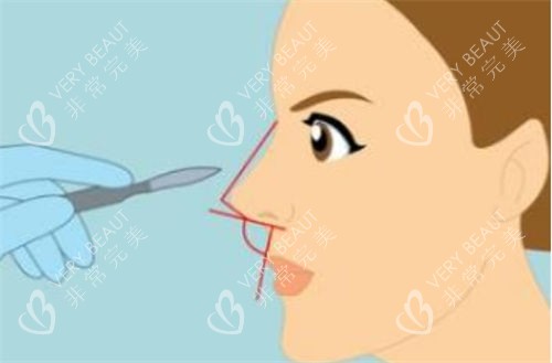 鼻部角度展示图图