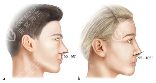 鼻子过长矫正对比