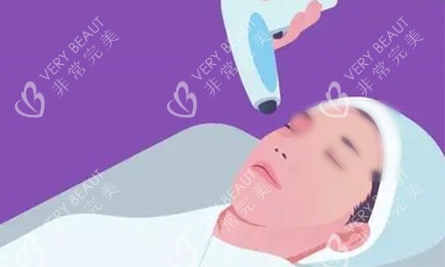 热玛吉操作示意图