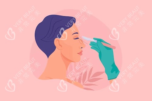 鼻部修复示意图