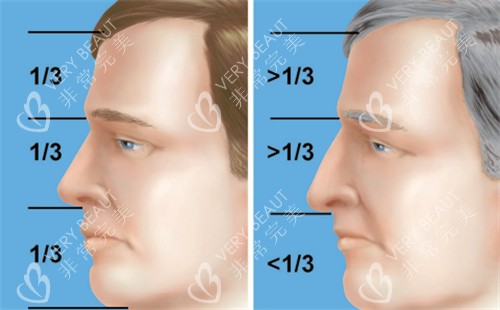 过长的鼻子和正常鼻子矫正对比