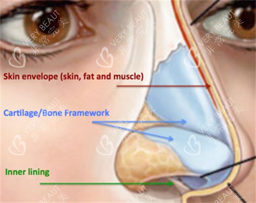 长鼻修复矫正对比