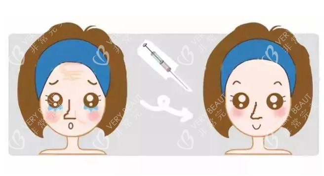 眼部注射前后对比图