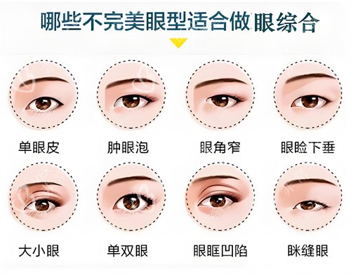 哪些眼型适合做眼综合示例动画图 哪些眼型适合做眼综合示例动画图