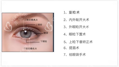 眼综合整形包含的部分项目演示图 眼综合整形包含的部分项目演示图