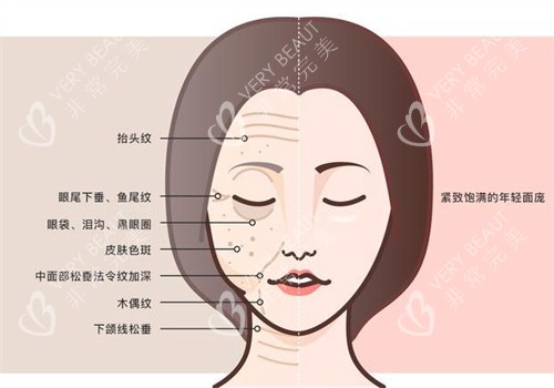 面部抗衰前后 面部抗衰前后