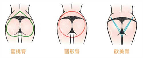 多种臀部形态素材图片