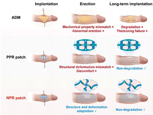男士增大增粗男科找 男士增大增粗男科找