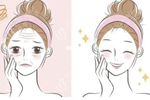 面部状态提升对比图 面部状态提升对比图