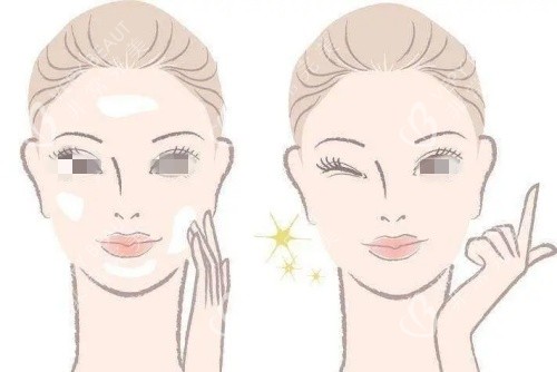 激光美白术后示意图_副本 激光美白术后示意图_副本