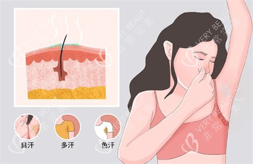 狐臭有哪些症状 狐臭有哪些症状