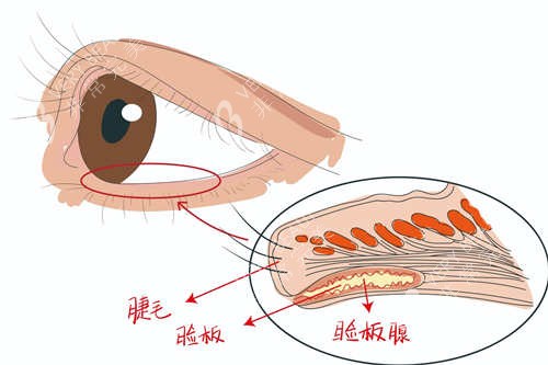 眼睑板位置