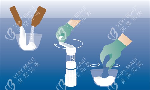 骨水泥制作 骨水泥制作