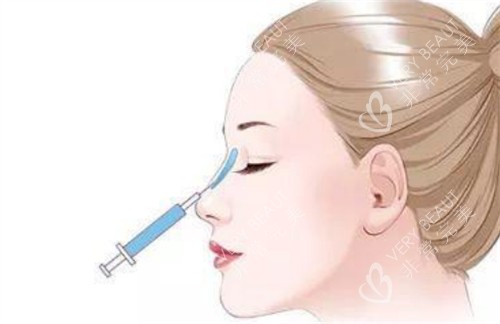 微晶瓷注射隆鼻过程 微晶瓷注射隆鼻过程